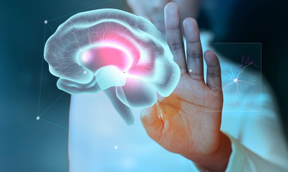 Aphasia Rehabilitation