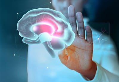 Aphasia Rehabilitation